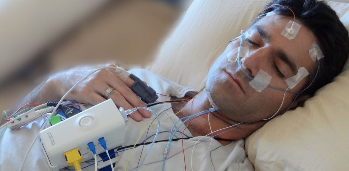 summit medical group sleep study